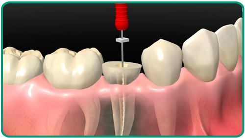 Tratamientos odontologicos