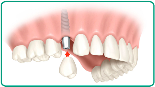 Tratamientos odontologicos
