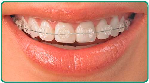 Tratamientos odontologicos