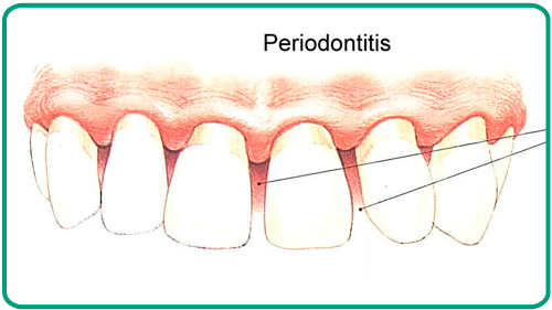 Tratamientos odontologicos