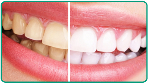 Tratamientos odontologicos
