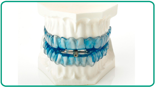 Tratamientos odontologicos